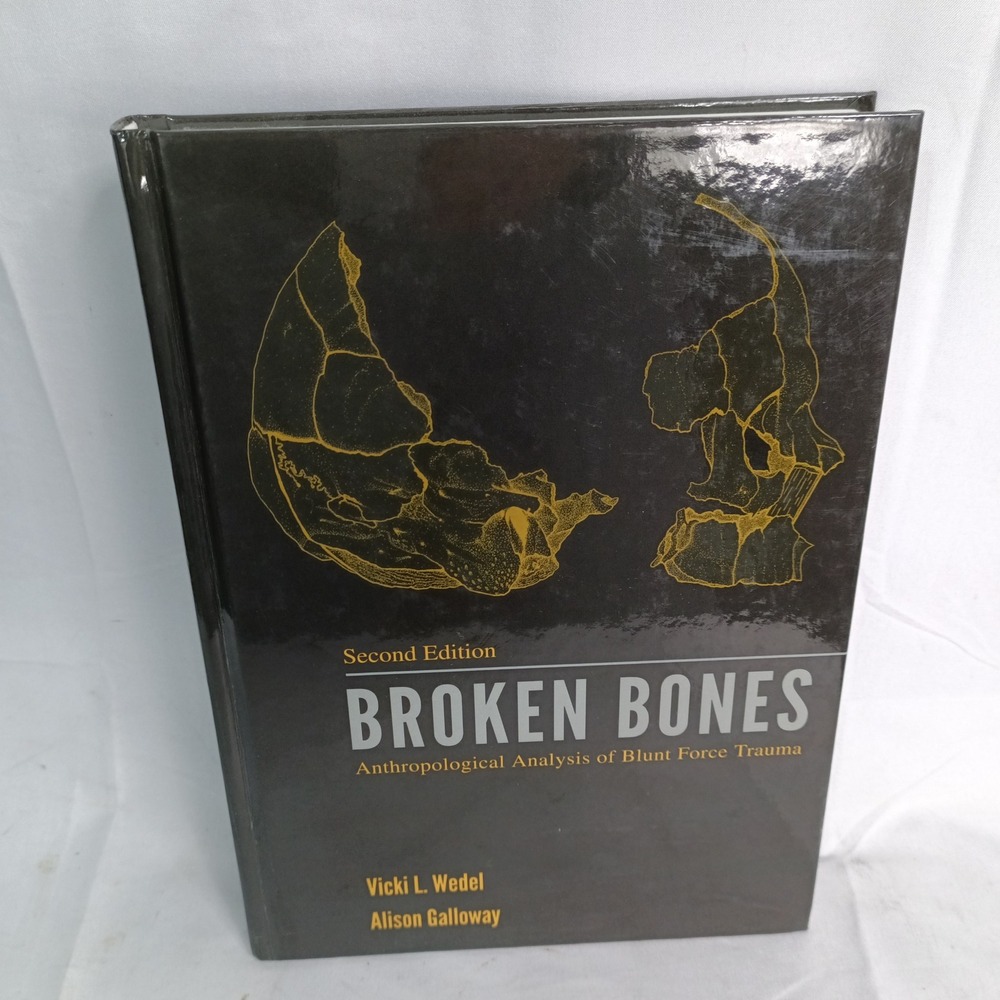 Broken Bones Anthropological Analysis Blunt Force Trauma 2nd Ed Wedel Galloway